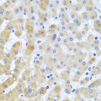 Immunohistochemistry of paraffin-embedded Human liver damage using EIF3M Polyclonal Antibody at dilution of  1:100 (40x lens).