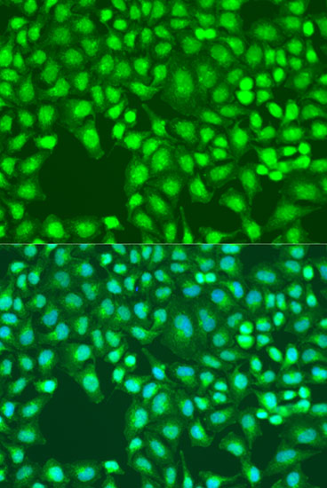 Immunofluorescence analysis of U2OS cells using Defb26 Polyclonal Antibody at dilution of  1:100. Blue: DAPI for nuclear staining.