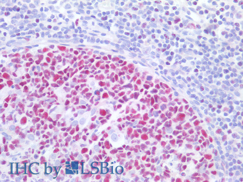 Immunohistochemistry of paraffin-embedded Human tonsil using MCM3 Polyclonal Antibody at dilution of 1:200(Elabscience Product Detected by Lifespan).