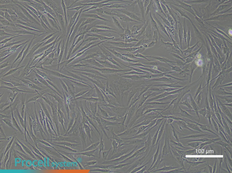 Human Dermal Fibroblast Complete Medium - 1