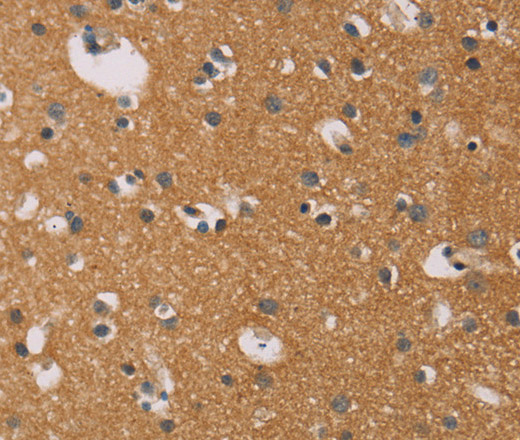 Immunohistochemistry of paraffin-embedded Human brain tissue using CD22 Polyclonal Antibody at dilution 1:50