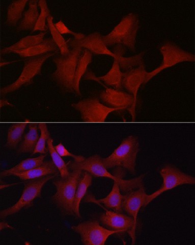 Immunofluorescence analysis of U2OS cells using GPX4 Polyclonal antibody at dilution of 1:200 (40x lens). Blue: DAPI for nuclear staining.