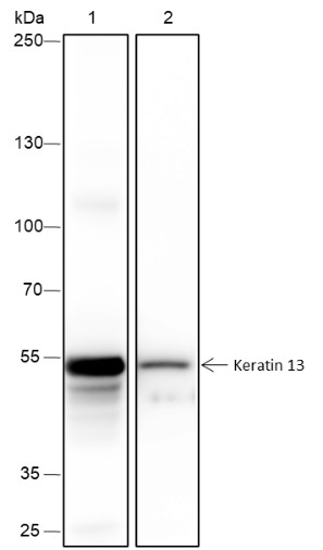 Recombinant Keratin 13 Monoclonal Antibody-searchlist-1