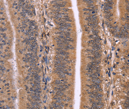 CLUAP1 Polyclonal Antibody - 2