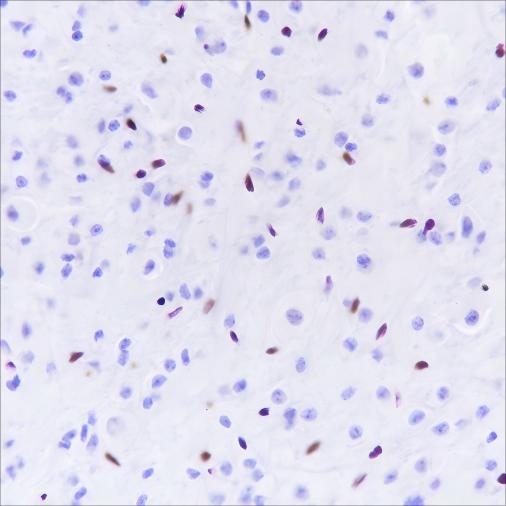 Recombinant ERG Monoclonal Antibody - small - 4