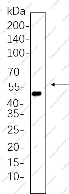Recombinant Cytokeratin 20 Monoclonal Antibody - 1