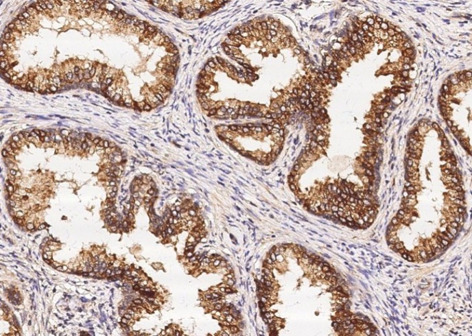 Recombinant ENTPD5 Monoclonal Antibody - small - 1
