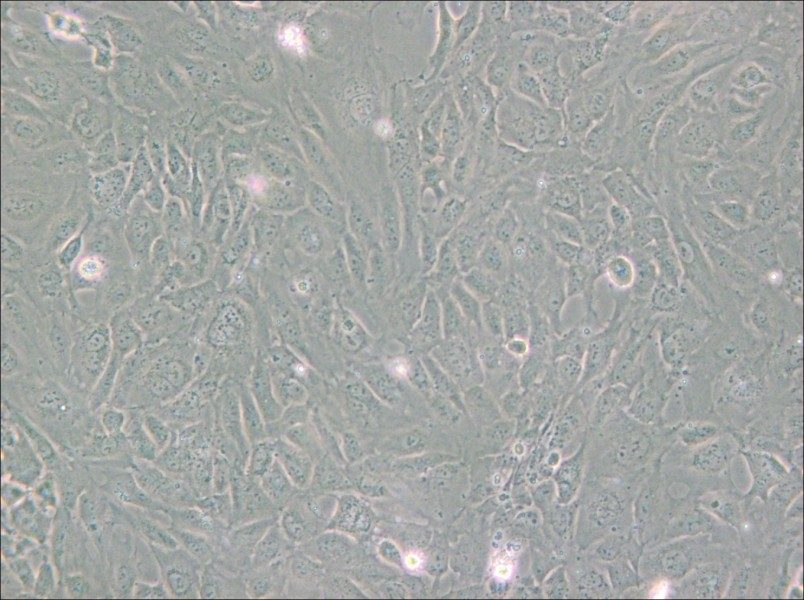 PUMC-HUVEC-T1 Cell Complete Medium - small - 6