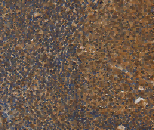DAB2 Polyclonal Antibody - 2