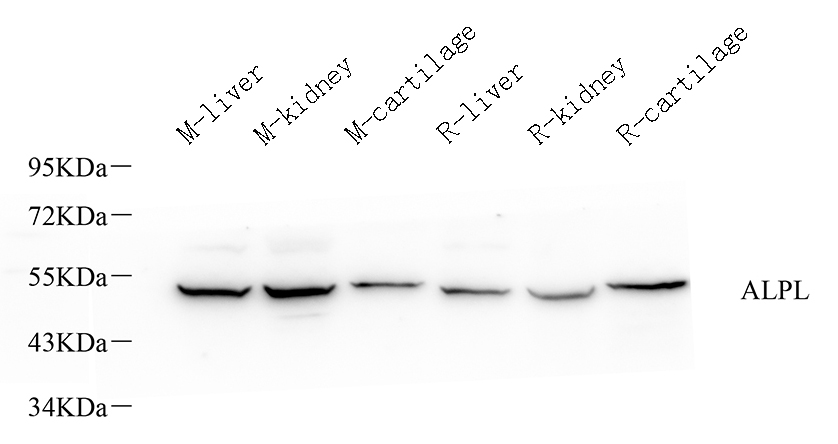 Western Blot analysis of various samples using ALPL Polyclonal Antibody at dilution of 1:1000.