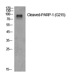 Western Blot analysis of Jurkat cells using Cleaved-PARP1 (G215) Polyclonal Antibody at dilution of 1:500.