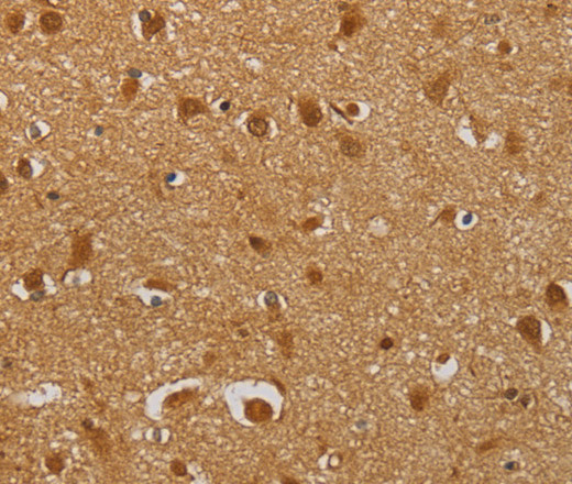 Immunohistochemistry of paraffin-embedded Human brain  using AHSG Polyclonal Antibody at dilution of 1:60