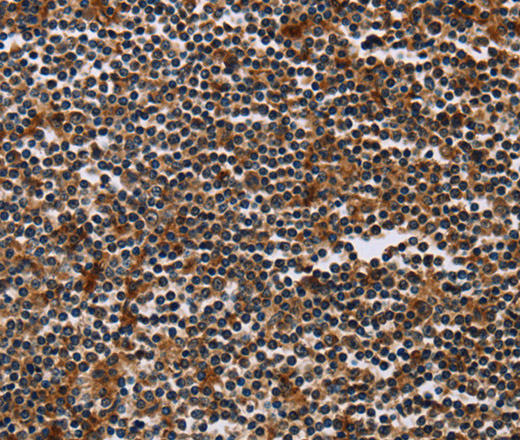 Immunohistochemistry of paraffin-embedded Human tonsil using MAGEA3 Polyclonal Antibody at dilution of 1:50