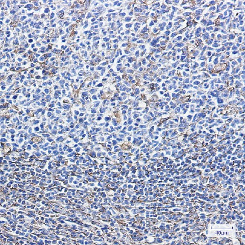 Immunohistochemistry of Vimentin in paraffin-embedded Human tonsil using Vimentin Rabbit mAb at dilution 1:100