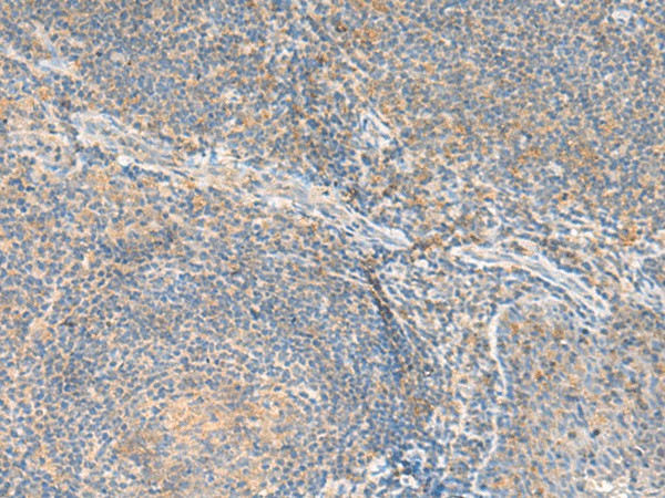 Immunohistochemistry of paraffin-embedded Human tonsil tissue  using RNF207 Polyclonal Antibody at dilution of 1:80(?200)