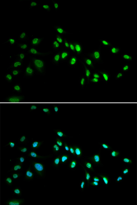 Immunofluorescence analysis of A549 cells using DNMT3A Polyclonal Antibody