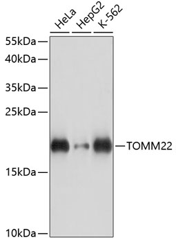 Western blot analysis of extracts of various cell lines using TOMM22 Polyclonal Antibody at dilution of 1:3000.