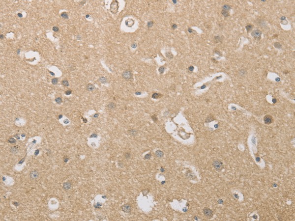 Immunohistochemistry of paraffin-embedded Human brain tissue  using P2RY11 Polyclonal Antibody at dilution of 1:30(?200)