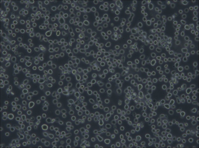 Karpas-299 Cell Complete Medium - 5