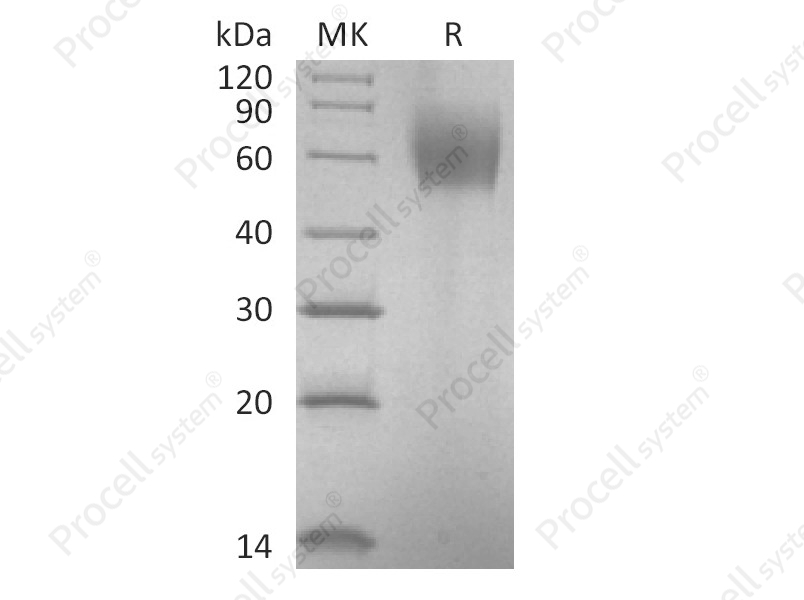 IL-23R (C-6His), Human, Recombinant