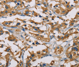 PIP4K2A Polyclonal Antibody - 2
