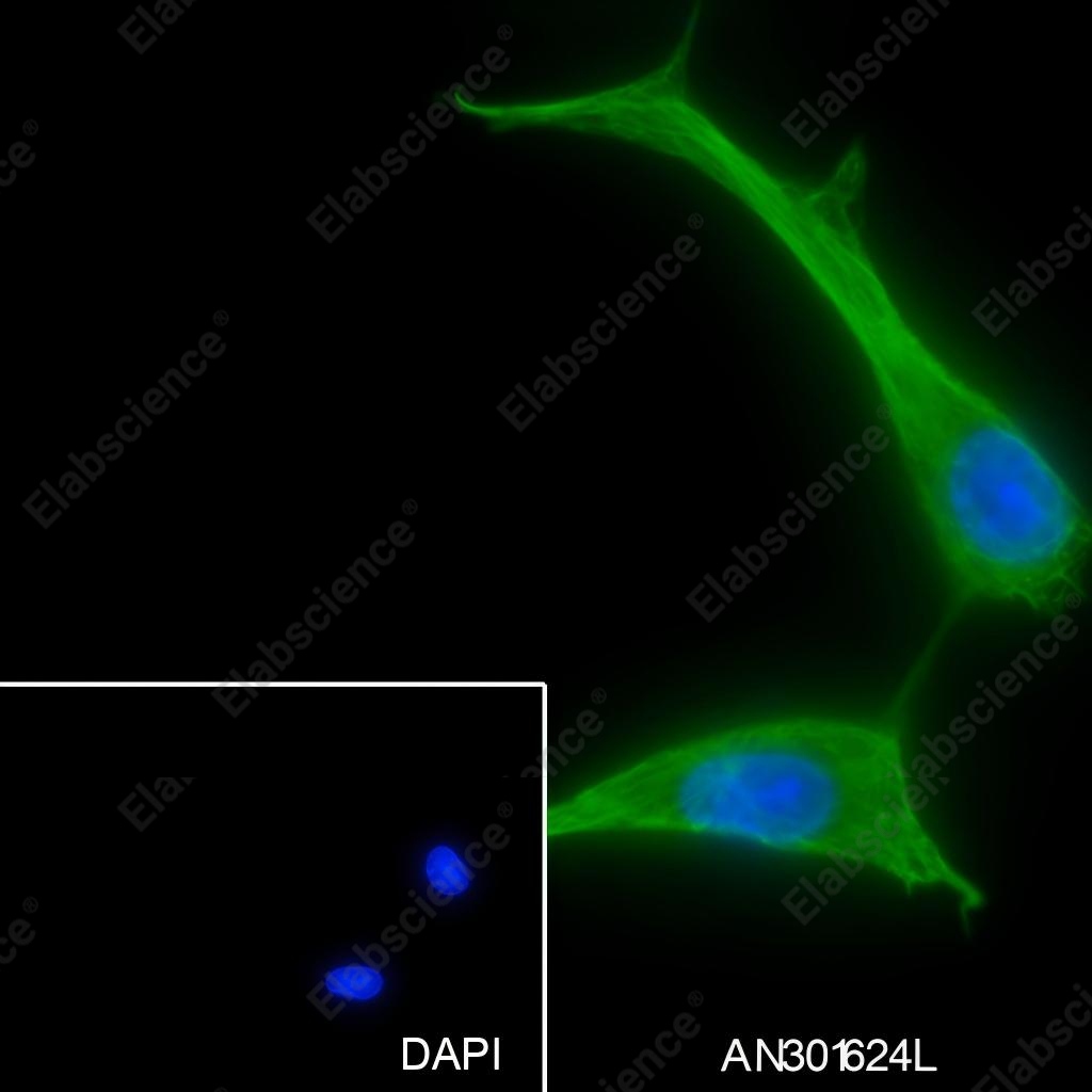 Recombinant PDP1 Monoclonal Antibody - 2