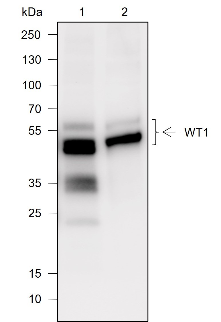 Recombinant WT1 Monoclonal Antibody - 2