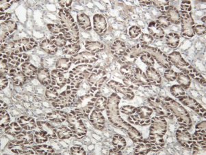 Recombinant S5A2 Monoclonal Antibody - 2