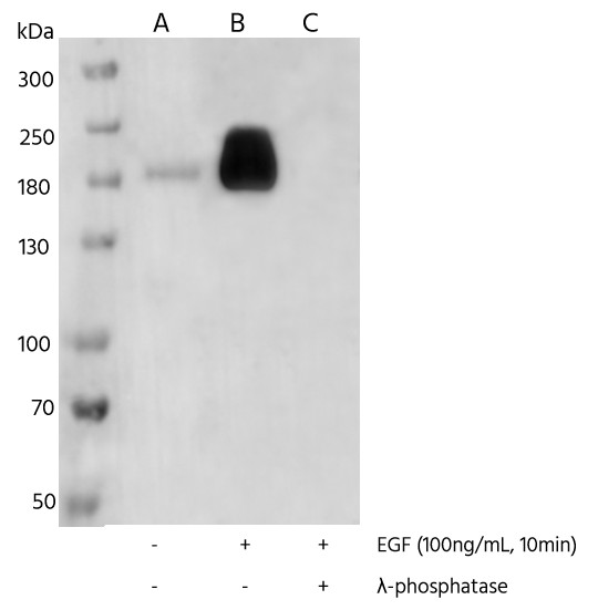 Recombinant Phospho-EGF Receptor (Tyr1068) Monoclonal Antibody - small - 4