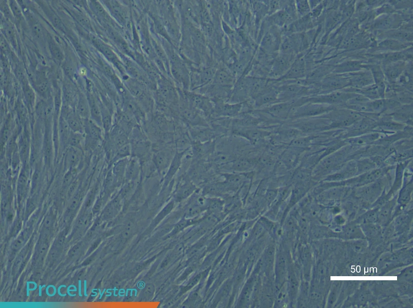 Human Bronchial Smooth Muscle Cell Complete Medium - 6