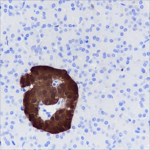 Recombinant SCGN Monoclonal Antibody-searchlist-1