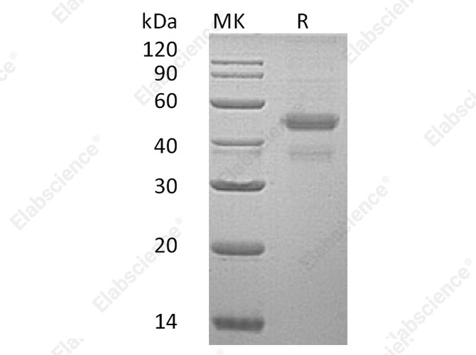 Recombinant Human ERP44 Protein (His Tag) - 1