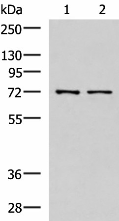 Western blot analysis of Mouse liver tissue and Jurkat cell lysates  using MKS1 Polyclonal Antibody at dilution of 1:700