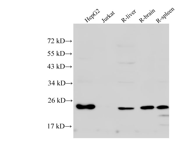 Western Blot analysis of HepG2, Jurkat cells, Rat liver, Rat brain and Rat spleen using RAN Polyclonal Antibody at dilution of 1:500