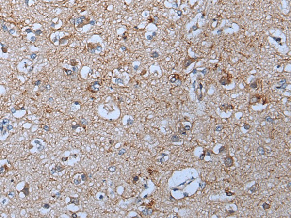 Immunohistochemistry of paraffin-embedded Human brain tissue  using YPEL5 Polyclonal Antibody at dilution of 1:60(?200)