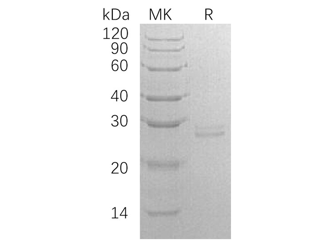 Recombinant Human RPE Protein (E.coli, His Tag)