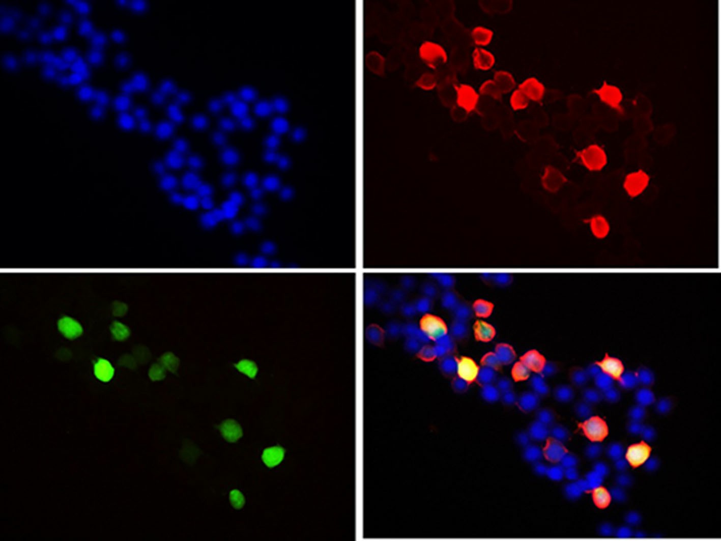 Immunofluorescent analysis of 293F cells transfected with the FLAG-GFP, using anti-Flag-Tag Monoclonal Antibody at 1:2000 dilution.