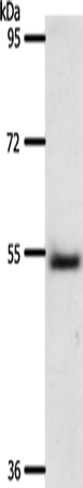 Western Blot analysis of Human liver cancer tissue using A1BG Polyclonal Antibody at dilution of 1:500