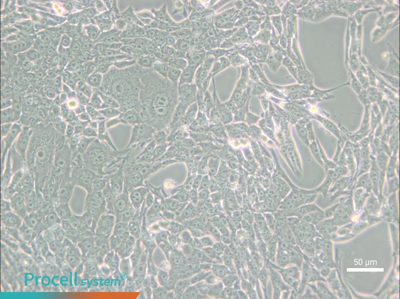 Renca [RenCa] Cell Complete Medium - small - 4