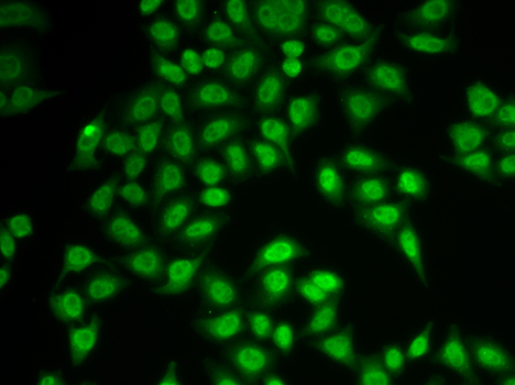 Immunofluorescence analysis of MCF-7 cells using PSMB9 Polyclonal Antibody