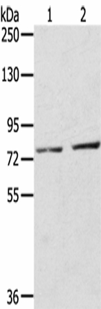 Western Blot analysis of A172 cells and Mouse liver tissue using ECE2 Polyclonal Antibody at dilution of 1/350