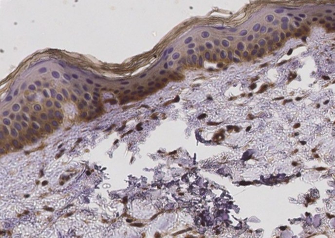 Recombinant FCGRT & B2M Heterodimer Monoclonal Antibody-searchlist-1