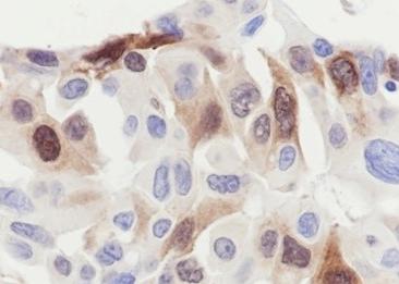 Recombinant Phospho-HSP27 (Ser78) Monoclonal Antibody-searchlist-2