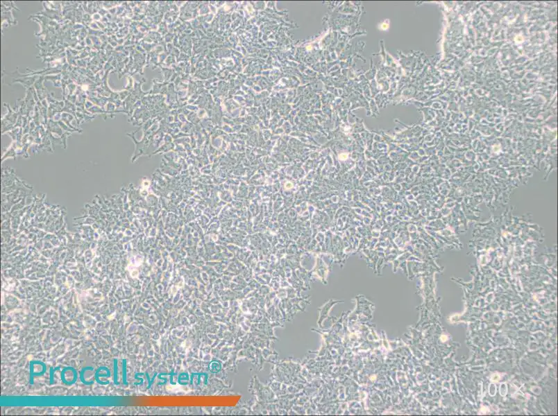 2V6.11 Cell Complete Medium - 1