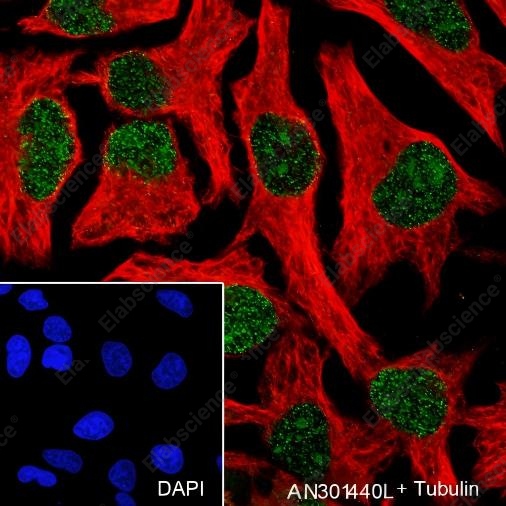 Recombinant Ataxin-3 Monoclonal Antibody - 4