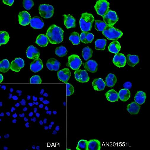 Recombinant HLA-DPB1 Monoclonal Antibody - small - 3
