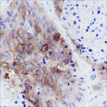 Recombinant TROP2 Monoclonal Antibody - small - 4