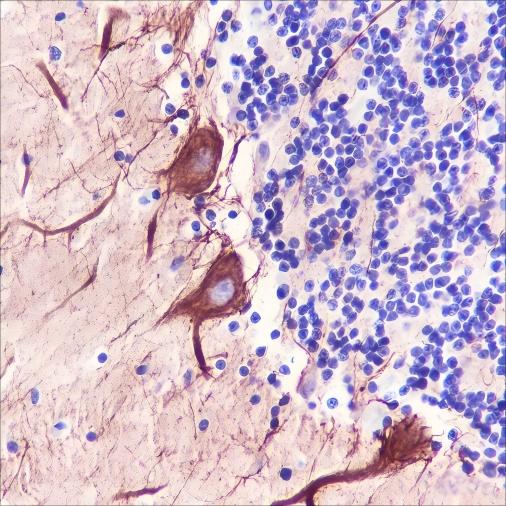 Recombinant PAK3 Monoclonal Antibody - 2