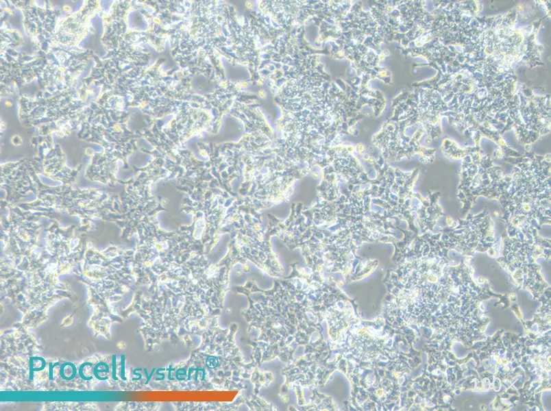 LS 174T [LS174T] Cell Complete Medium - 3