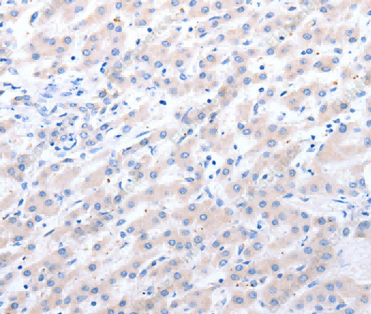 ALDH1A1/2/3 Polyclonal Antibody - 2